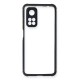 Xiaomi Mi 10T Pro Kılıf Miami Şeffaf Silikon - Lacivert