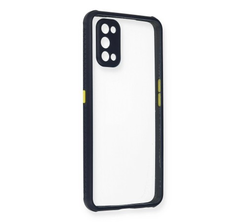 Realme 7 Pro Kılıf Miami Şeffaf Silikon - Lacivert