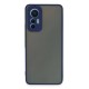 Xiaomi Mi 12 Lite Kılıf Montreal Silikon Kapak - Lacivert