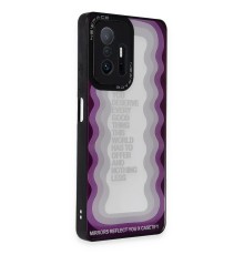 Xiaomi Mi 11T Pro Kılıf Mirror Desenli Kapak - Mirror - 5