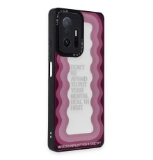 Xiaomi Mi 11T Pro Kılıf Mirror Desenli Kapak - Mirror - 11