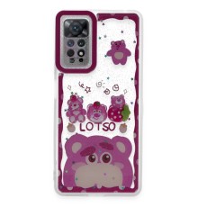 Xiaomi Redmi Note 11 Kılıf Sweet Desenli Silikon Kapak - Pembe