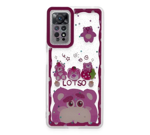 Xiaomi Redmi Note 11 Kılıf Sweet Desenli Silikon Kapak - Pembe