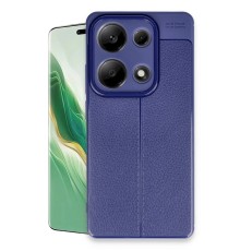 Xiaomi Redmi Note 13 Pro 4G Kılıf Auto Focus Kapak - Lacivert
