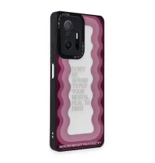 Xiaomi Mi 11T Pro Kılıf Mirror Desenli Kapak - Mirror - 11