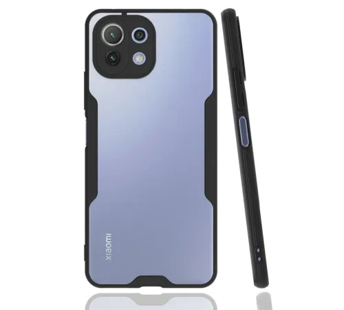 Xiaomi Mİ 11 Lite Kılıf Platin Silikon - Siyah Xiaomi Mİ 11 Lite Kılıf Platin Silikon - Siyah