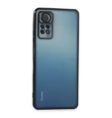 Newface Xiaomi Redmi Note 11 Pro Kılıf Razer Lensli Silikon - Siyah