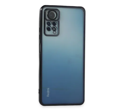 Newface Xiaomi Redmi Note 11 Pro Kılıf Razer Lensli Silikon - Siyah Newface Xiaomi Redmi Note 11 Pro Kılıf Razer Lensli Silikon - Siyah